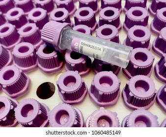 A View Of Mini Blood Tube Isolated On Top Of Blood Tube Cap As Background