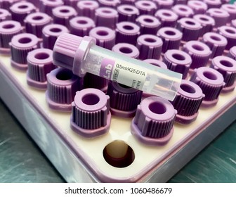 A View Of Mini Blood Tube Isolated On Top Of Blood Tube Cap As Background