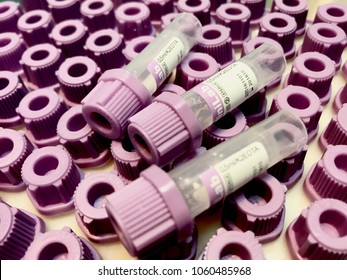 A View Of Mini Blood Tubes Isolated On Top Of Blood Tube Cap As Background