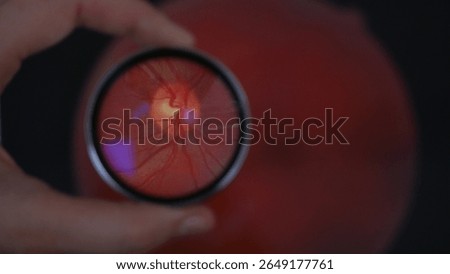 View of optic disc during examination of retina while holding 20 diopter lens. A routine fundus screening method during eye exam.