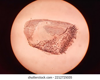view under a microscope types of ctenoid scales in gouramy