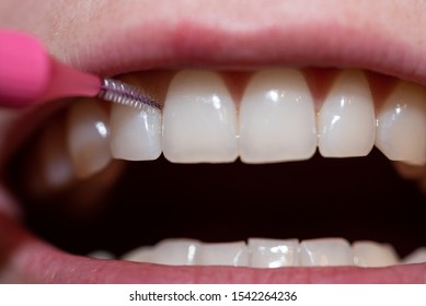 3,464 Interdental Images, Stock Photos & Vectors | Shutterstock