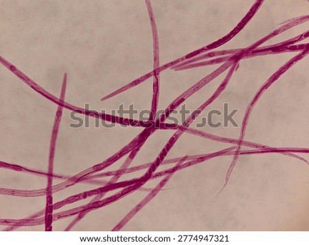 Vinegar Eel Nematode Whole Mount Showing Elongated Transparent Body Structure