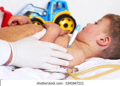 Viral Disease. Measles Rash. Concept Doctor And Patient. Child With Viral Infection Measles . The Doctor Measures The Temperature Of Baby.