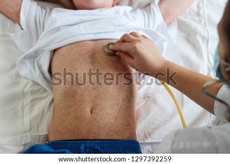 Viral disease. Measles rash. Concept doctor and patient. Doctor with stethoscope and child with viral infection measles