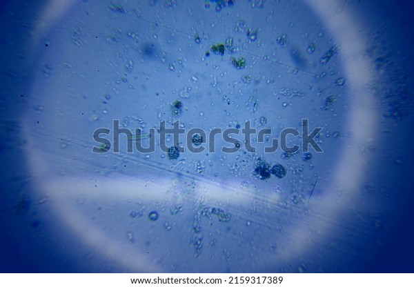 viruses and bacteria\
under the microscope
