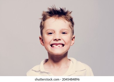 Visit To The Dentist. The First Tooth Fell Out. Boy Blond Without Tooth Cheerfully Smiles Showing Teeth.