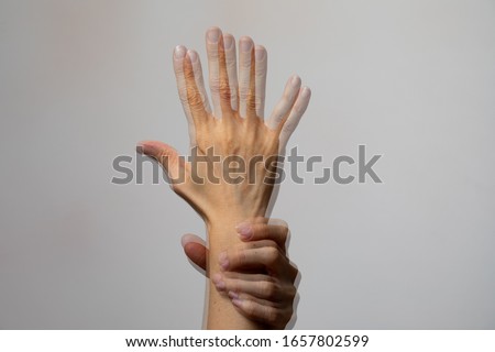 Visual defect that causes diplopia, double perception of an image, close-up of the hand