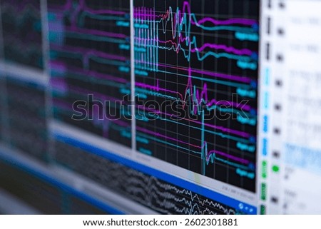 Visualizing brain activity data. Colorful waveforms represent brain activity during an EEG recording in a clinical setting.
