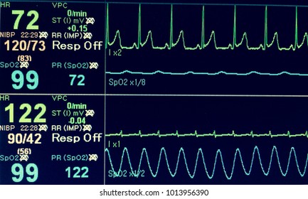 Vital Sign Ekg Monitor.