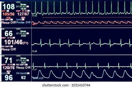 Vital Sign Ekg Monitor.