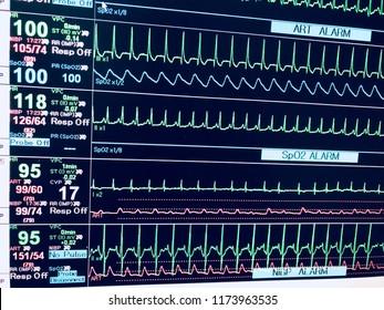 Vital sign ekg monitor. Medical and healthcare concept.