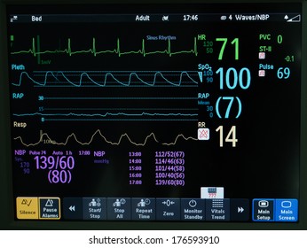 Vital Sign Monitor In ICU EKG, Oxymetry And Blood Pressure 