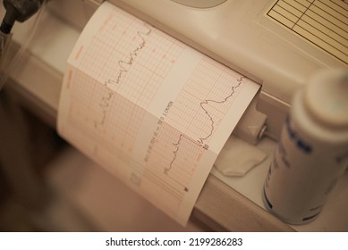 Vital Sign Print Paper In Recovery Room                 