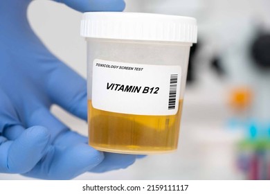 Vitamin B12 Vitamin B12 Urinalysis Urine Stock Photo 2159111117 ...