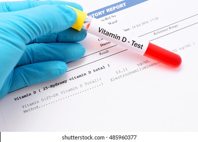 Vitamin D Testing Result With Blood Sample