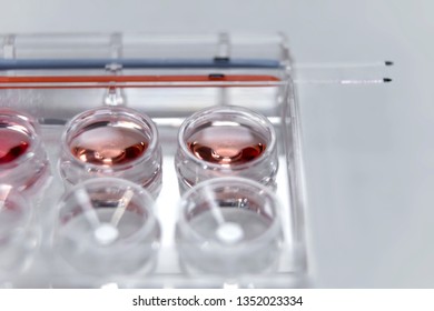 Vitrification Technique In Laboratory