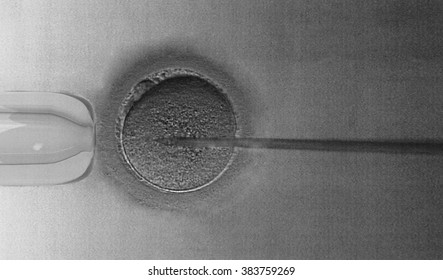 In vitro ferstilisation IVF - Insemination of female egg