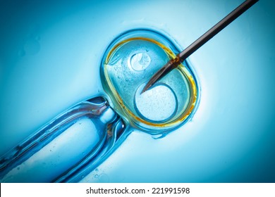 In Vitro Fertilisation, IVF Macro Concept