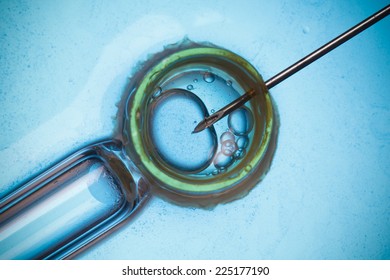 In Vitro Fertilisation, IVF Macro Concept