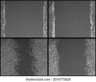 In Vitro Wound Healing Assay. Cells Were Imaged At The Start Of The Experiment (top) And 24 Hours Later (bottom). Cells On The Left Were Untreated. Cells On The Right Were Subjected To An Inhibitor