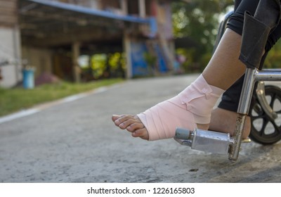 Volunteers Are Provided To Patient Ankle Wrap Elastic Bandage, With Patient Ankle Injury. Patient Wheelchair.