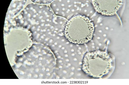 Volvox structure under the microscope
