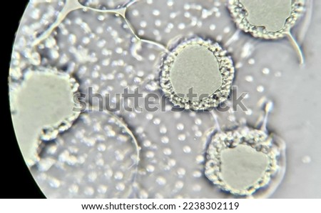 Volvox structure under the microscope