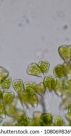 Vorticella Organism Waste Water Under Microscope Stock Photo 1080698369 ...