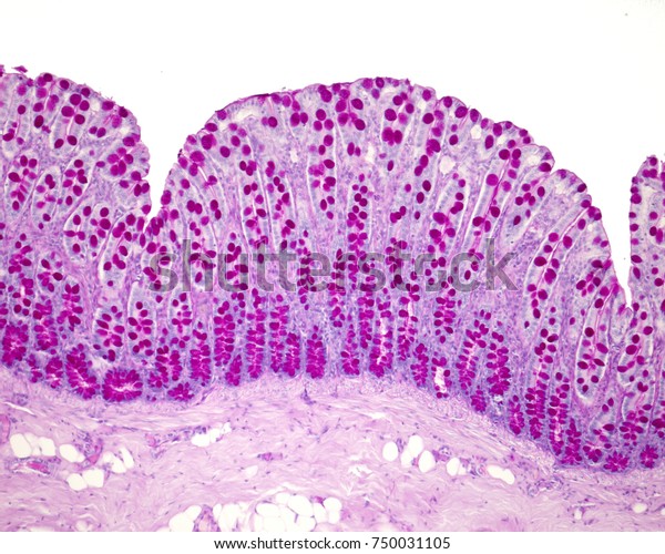 Wall of the large intestine stained with the PAS\
technique. This method highlights the goblet cells in the\
Lieberkühn crypts of the colon\
mucosa.