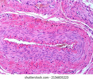 
Wall Of A Large Muscular Artery, Showing From The Central Lumen: Endothelial Cell Nuclei, Wavy Internal Elastic Lamina, Median Layer With Smooth Muscle Fibres, And Adventitia With Many Collagen Fiber