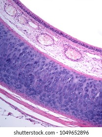 Wall Of The Trachea Showing The Mucosa Layer (respiratory Epithelium And Lamina Propria, With Large Blood Vessels), The Hyaline Tracheal Cartilage And The Adventitia Layer. 