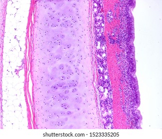 Wall of the trachea showing from right to left: mucosa layer with respiratory epithelium and lamina propria with some mucous glands, hyaline cartilage ring and adventitia layer
