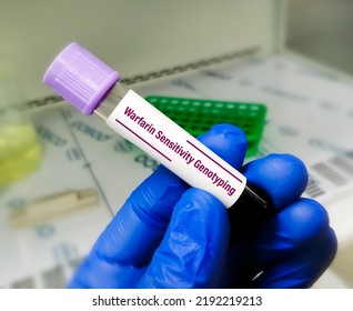 Warfarin Sensitivity Genotyping Testing In PCR Laboratory, To Diagnose The Tolerance Of The Drug Warfarin.