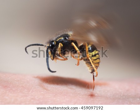 Wasp sting pulls out of human skin. macro
