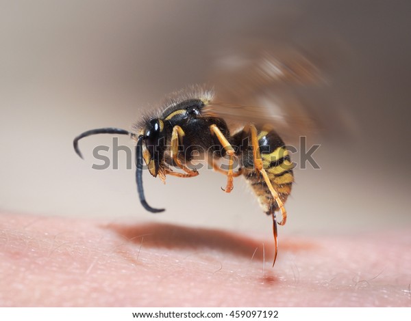 Wasp sting pulls out\
of human skin. macro