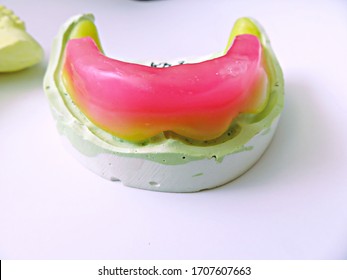 Wax Rim Of Complete Denture