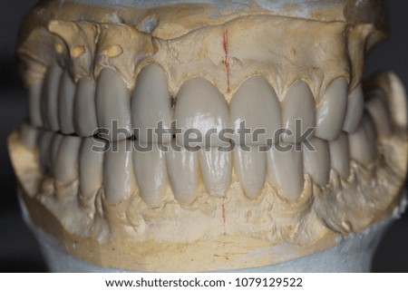 waxing crowns for the missing teeth
