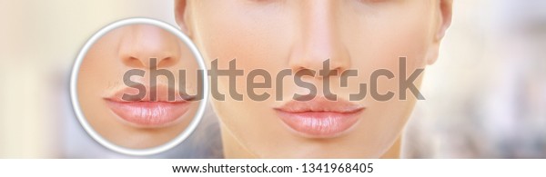 Waxing Epilationthreadinghair Removal Creamlaserupper Lip Hair Stock Photo Edit Now 1341968405 shutterstock