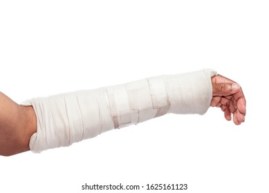 Wearing A Splint For Broken Arm Patient On White Background