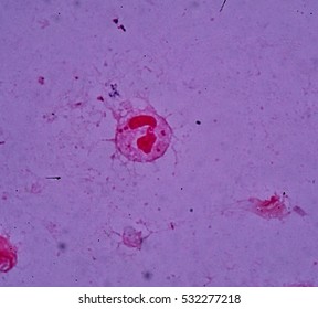 Wet Smear Undermicroscropy Showing Gramnegative Intracellular Stock ...