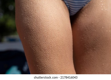 Wet Woman Legs With Goosebumps, Close Up