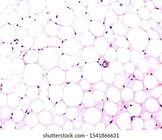 White adipose tissue stained with HE. Adipocytes (fat cells) contains a large lipid droplet surrounded by a thin layer of cytoplasm. The nucleus is flattened and located on the periphery