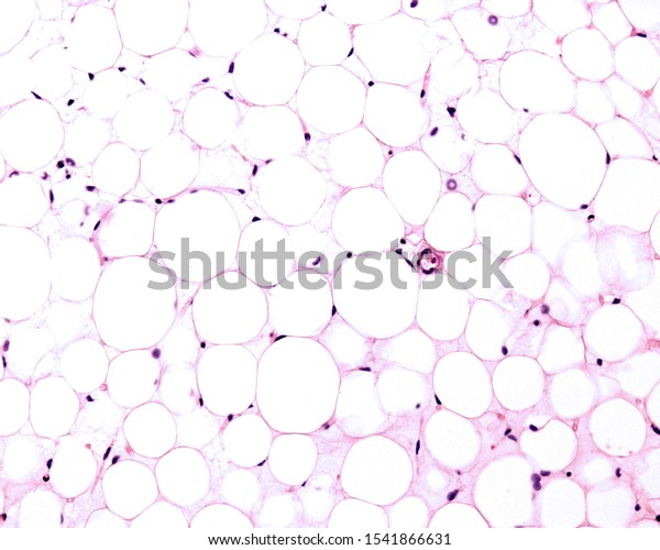 White\
adipose tissue stained with HE. Adipocytes (fat cells) contains a\
large lipid droplet surrounded by a thin layer of cytoplasm. The\
nucleus is flattened and located on the\
periphery