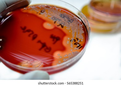 Colonies White Bacteria Beta Hemolysis Culture Photo De Stock