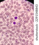 White blood cell in microscope 