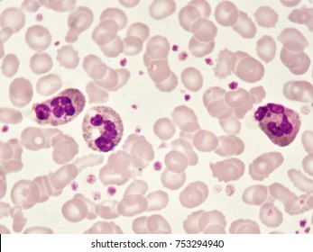 White Blood Cell Blood Smear Analyze Stock Photo (Edit Now) 753294940