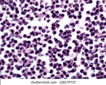 White Blood Cells Human Photomicrograph Panorama Stock Photo 128179727 ...