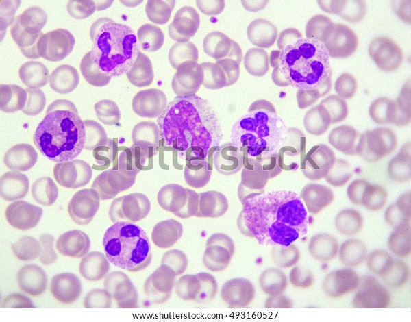 White Blood Cells Peripheral Blood Smear Stock Photo (Edit Now) 493160527