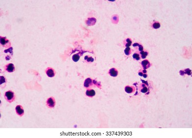 10 Granulocytes Bag Images, Stock Photos & Vectors | Shutterstock